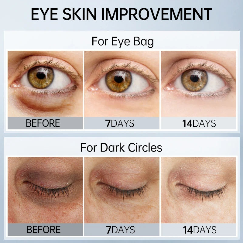 Peptide Eye Cream Dark Circles Remove Eye Bags Puffiness Reduces Wrinkles Lifting Firming Eye Serum Man Woman Eye Care Beauty